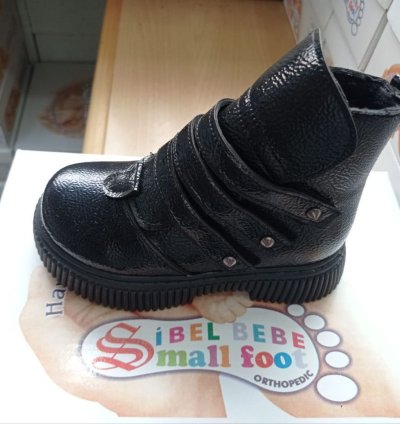 👟 Why Orthopedic Boots Are Important for Children’s Foot Development 3